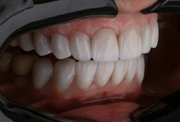 Como a saúde bucal impacta na autoestima e nas relações sociais